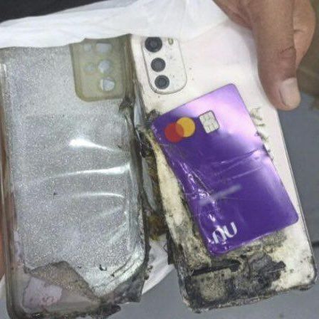 手机突爆炸牛仔裤冒火球致二级烧伤。凯发K8旗舰店APP巴西女逛超市(图3)